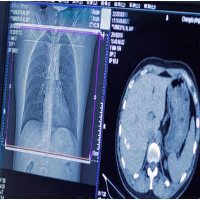 Davidson Belluso Designs Expertise For The Experts At Imaging Endpoints