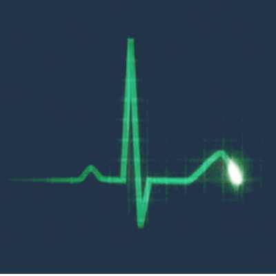 New WordPress Reporting & Maintenance Packages